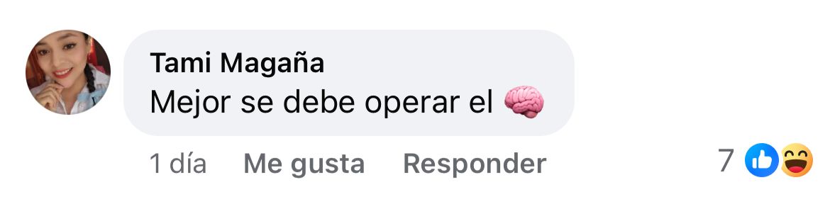 Recomiendan a Ninel Conde una operación de cerebro