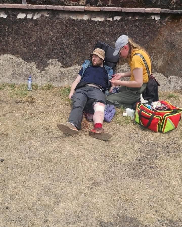 heridos balacera en Teotihuacán